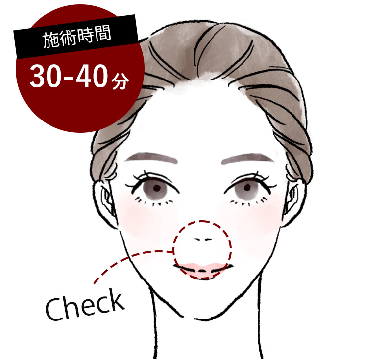 施術時間30-40分